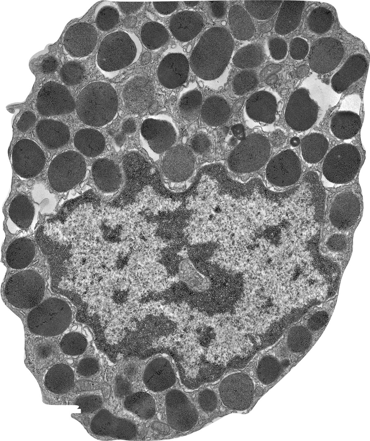 Mast cells: An amplifier of the inflammatory response