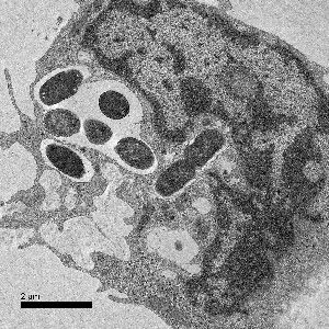 Fight between defense cell ‘neutrophil’ and pathogenic bacteria.