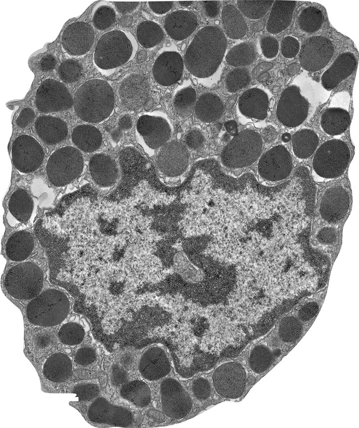 Mast cells: An amplifier of the inflammatory response